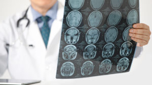 Neurochirurgie